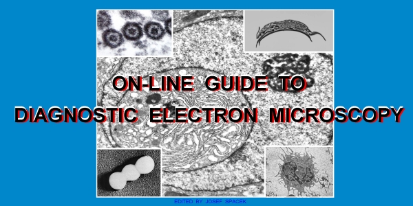 On-line Guide to Diagnostic Electron Microscopy On-line Guide to Diagnostic Electron Microscopy